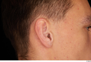 Alessandro Katz ear 0002.jpg